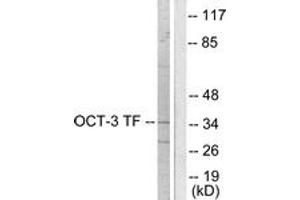 Western Blotting (WB) image for anti-POU Class 5 Homeobox 1 (POU5F1) (AA 191-240) antibody (ABIN2889240) (OCT4 Antikörper  (AA 191-240))