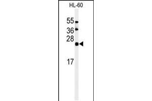 Western blot analysis of in HL-60 cell line lysates (35ug/lane) (ISG15 Antikörper  (C-Term))