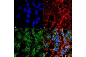 Immunocytochemistry/Immunofluorescence analysis using Rabbit Anti-UVRAG Polyclonal Antibody . (UVRAG Antikörper  (Biotin))