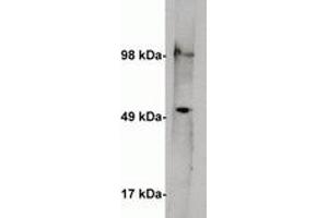 Image no. 1 for anti-serine Palmitoyltransferase, Long Chain Base Subunit 1 (SPTLC1) antibody (ABIN201813) (SPTLC1 Antikörper)