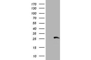 HEK293T cells were transfected with the pCMV6-ENTRY control (Left lane) or pCMV6-ENTRY RFXANK (Right lane) cDNA for 48 hrs and lysed. (RFXANK Antikörper)