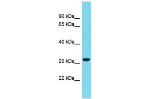 Host: Rabbit Target Name: METRNL Sample Type: Fetal Liver lysates Antibody Dilution: 1. (METRNL Antikörper  (C-Term))