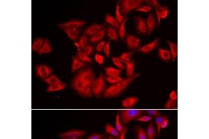 Immunofluorescence analysis of U2OS cells using TLK2 Polyclonal Antibody (TLK2 Antikörper)