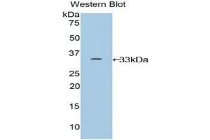 Detection of Recombinant CYP24A1, Mouse using Polyclonal Antibody to Cytochrome P450 24A1 (CYP24A1) (CYP24A1 Antikörper  (AA 260-514))