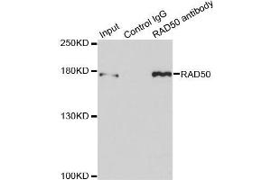 Immunoprecipitation analysis of 150 μg extracts of MCF7 cells using 3 μg RAD50 antibody (ABIN5971576). (RAD50 Antikörper)
