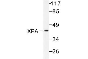 Image no. 1 for anti-Xeroderma Pigmentosum, Complementation Group A (XPA) antibody (ABIN271978) (XPA Antikörper)