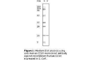 Image no. 2 for anti-CD19 Molecule (CD19) antibody (ABIN207604) (CD19 Antikörper)