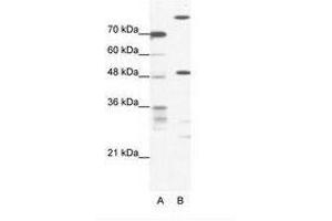 Image no. 1 for anti-NFS1, Cysteine Desulfurase (NFS1) (AA 151-200) antibody (ABIN202565) (NFS1 Antikörper  (AA 151-200))