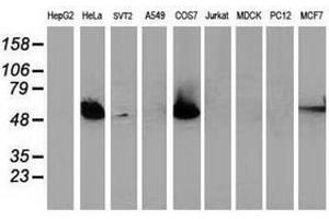Image no. 2 for anti-Tumor Protein P53 (TP53) antibody (ABIN1499975) (p53 Antikörper)