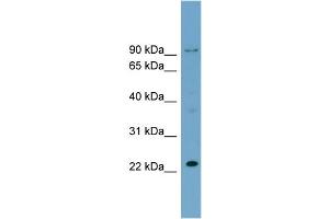 WB Suggested Anti-C15orf15  Antibody Titration: 0. (RSL24D1 Antikörper  (Middle Region))