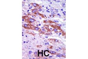 Immunohistochemistry (IHC) image for anti-Casein Kinase 1, delta (CSNK1D) antibody (ABIN3003190) (Casein Kinase 1 delta Antikörper)