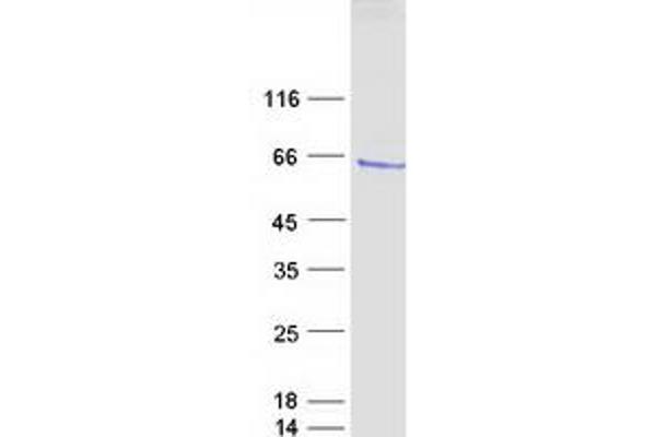 ETV1 Protein (Myc-DYKDDDDK Tag)