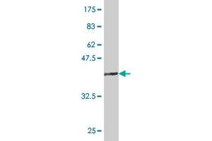 Western Blot detection against Immunogen (36. (TLX3 Antikörper  (AA 192-291))