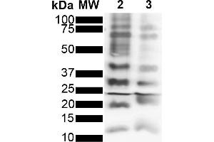 Western Blot analysis of Purified poly-ubiquitin chains showing detection of Multiple Ubiquitin protein using Rabbit Anti-Ubiquitin Monoclonal Antibody, Clone FK2 (ABIN5695851). (Ubiquitin Antikörper  (FITC))