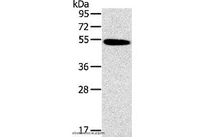 Western blot analysis of Human normal colon tissue, using HRH1 Polyclonal Antibody at dilution of 1:200 (HRH1 Antikörper)