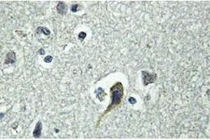 Image no. 2 for anti-Parathyroid Hormone 1 Receptor (PTH1R) antibody (ABIN317698) (PTH1R Antikörper)