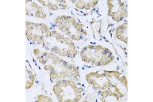 Immunohistochemistry of paraffin-embedded human stomach using RCN2 antibody. (RCN2 Antikörper)