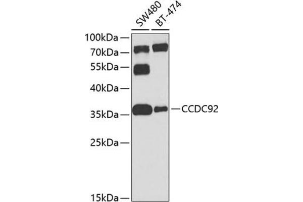 CCDC92 Antikörper  (AA 1-331)