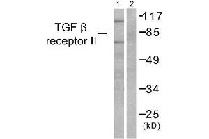 Western Blotting (WB) image for anti-Transforming Growth Factor, beta Receptor II (70/80kDa) (TGFBR2) (Internal Region) antibody (ABIN1848792) (TGFBR2 Antikörper  (Internal Region))