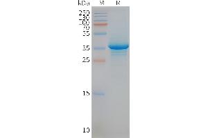 Human ST-Nanodisc, Flag Tag on SDS-PAGE (STEAP1 Protein)