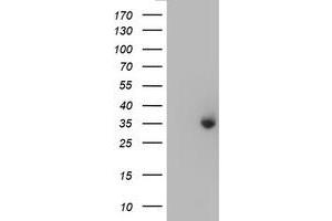 HEK293T cells were transfected with the pCMV6-ENTRY control (Left lane) or pCMV6-ENTRY ERCC1 (Right lane) cDNA for 48 hrs and lysed. (ERCC1 Antikörper)