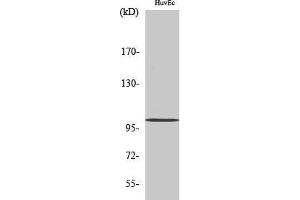 Western Blotting (WB) image for anti-N(alpha)-Acetyltransferase 15, NatA Auxiliary Subunit (NAA15) (Internal Region) antibody (ABIN6281956) (NAA15 Antikörper  (Internal Region))