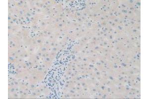 IHC-P analysis of Human Liver Tissue, with DAB staining. (SQSTM1 Antikörper  (AA 136-400))