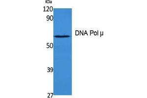 Western Blotting (WB) image for anti-Polymerase (DNA Directed), mu (POLM) (Internal Region) antibody (ABIN6282225) (POLM Antikörper  (Internal Region))