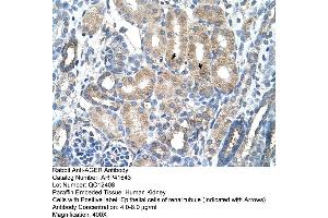 Rabbit Anti-AGER Antibody  Paraffin Embedded Tissue: Human Kidney Cellular Data: Epithelial cells of renal tubule Antibody Concentration: 4. (RAGE Antikörper  (C-Term))