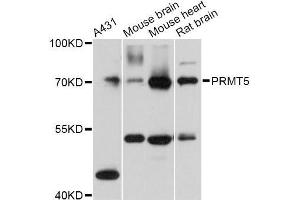 Western blot analysis of extracts of various cell lines, using PRMT5 Antibody (ABIN5970714) at 1:3000 dilution. (PRMT5 Antikörper)