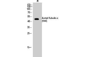 Western Blot analysis of JK cells using Acetyl-Tubulin α (K40) Polyclonal Antibody. (alpha Tubulin Antikörper  (acLys40))