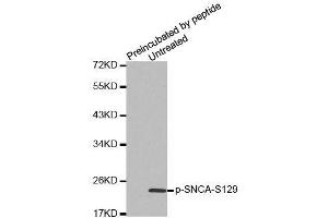 Western blot analysis of extracts from mouse brain tissue, using Phospho-SNCA-S129 antibody (ABIN2988301). (SNCA Antikörper  (pSer129))