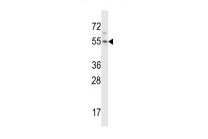 Western blot analysis in Hela cell line lysates (35ug/lane). (H13 Antikörper  (C-Term))