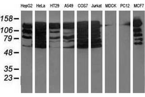 Western blot analysis of extracts (35 µg) from 9 different cell lines by using anti-BUB1B monoclonal antibody. (BUB1B Antikörper)