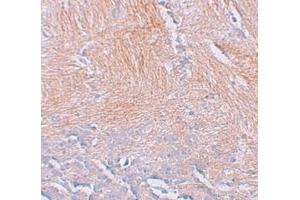 Immunohistochemistry (IHC) image for anti-CXXC Finger Protein 5 (CXXC5) (N-Term) antibody (ABIN1031339) (CXXC5 Antikörper  (N-Term))