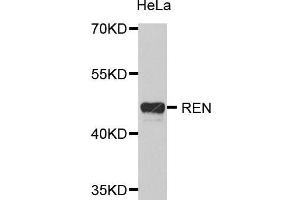 Western Blotting (WB) image for anti-Renin (REN) (AA 24-160) antibody (ABIN6218656) (Renin Antikörper  (AA 24-160))
