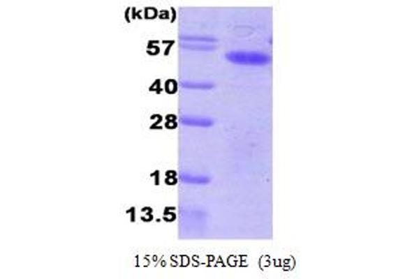 Aurora A Protein (AA 1-403) (His tag)