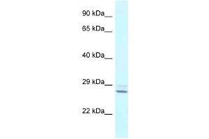 Western Blot showing TPPP antibody used at a concentration of 1 ug/ml against Fetal Liver Lysate (Tppp Antikörper  (N-Term))