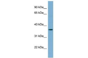 C1ORF75 antibody used at 1 ug/ml to detect target protein. (TMEM206 Antikörper  (N-Term))