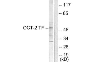 Western Blotting (WB) image for anti-POU domain, class 2, transcription factor 2 (POU2F2) (N-Term) antibody (ABIN1848707) (Oct-2 Antikörper  (N-Term))