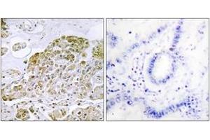 Immunohistochemistry (IHC) image for anti-Transcription Factor EB (TFEB) (AA 10-59) antibody (ABIN2889416) (TFEB Antikörper  (AA 10-59))