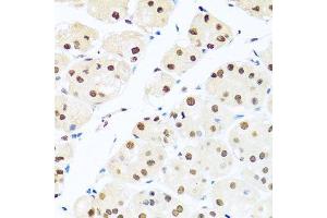 Immunohistochemistry of paraffin-embedded human stomach using RAB3IP antibody. (RAB3IP Antikörper  (AA 1-150))