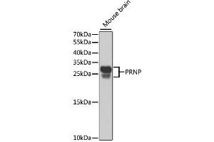 Western blot analysis of extracts of mouse brain, using PRNP antibody. (PRNP Antikörper)