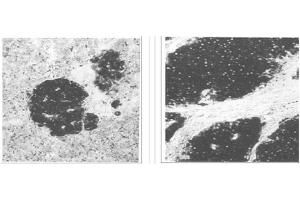 Image no. 1 for anti-Enolase 2 (Gamma, Neuronal) (ENO2) antibody (ABIN211314) (ENO2/NSE Antikörper)