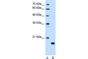 Western Blotting (WB) image for anti-Complement Component 8, beta Polypeptide (C8B) antibody (ABIN2462793) (C8B Antikörper)