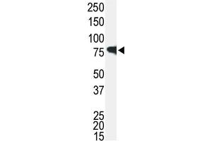 Western blot analysis of IRAK1 Antibody in Jurkat cell lysate. (IRAK1 Antikörper)