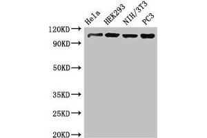Western Blot Positive WB detected in: Hela whole cell lysate, HEK293 whole cell lysate, NIH/3T3 whole cell lysate, PC-3 whole cell lysate All lanes: NUP107 antibody at 3. (NUP17 (AA 1-66) Antikörper)