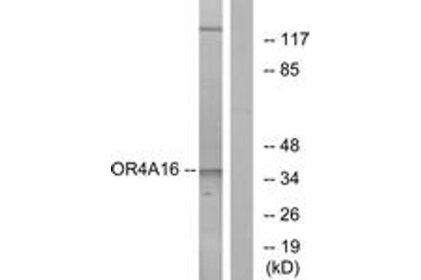 OR4A16 Antikörper  (AA 261-310)