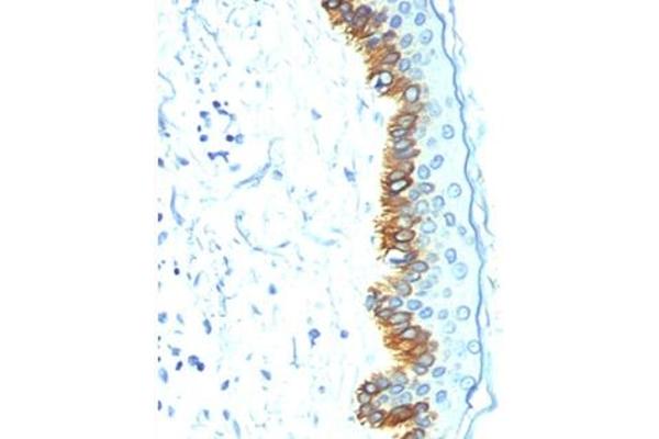 Keratin Acidic (AE1) Antikörper