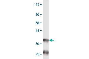 Western Blot detection against Immunogen (36. (BAAT Antikörper  (AA 258-355))